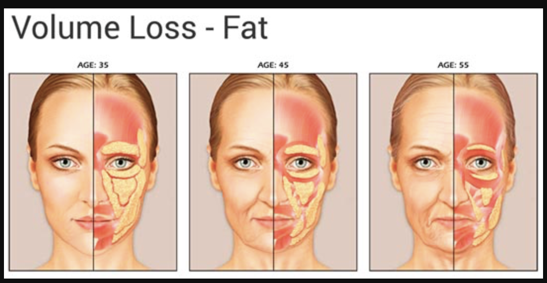 perda de gordura com a face
